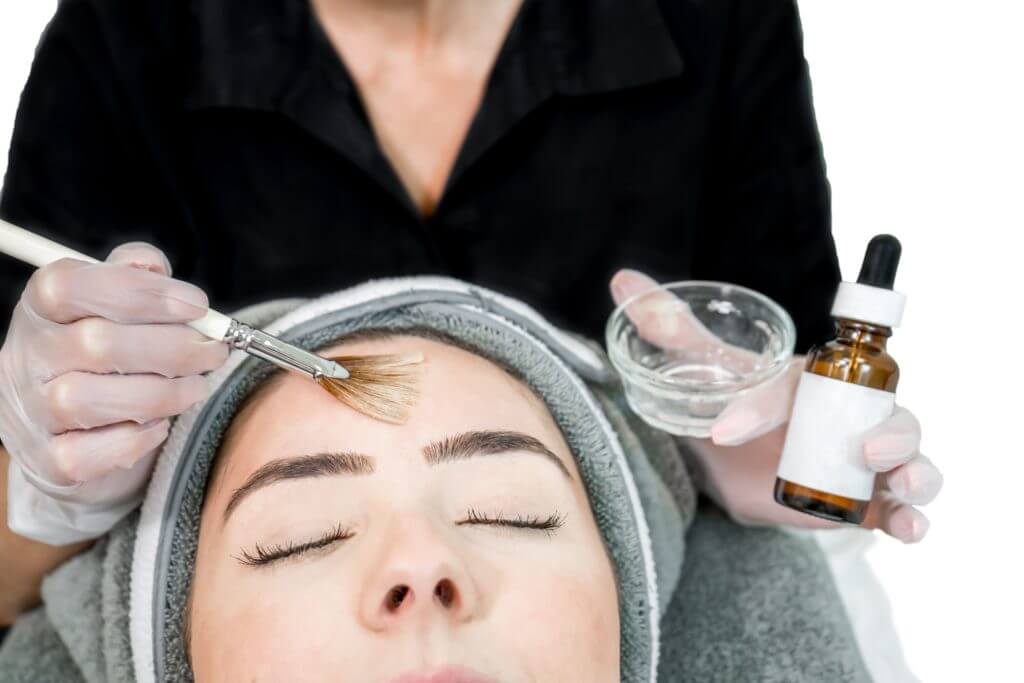 Which is better chemical peeling or laser treatment?